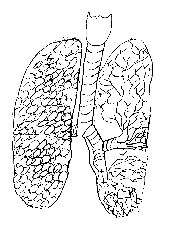 Lungs